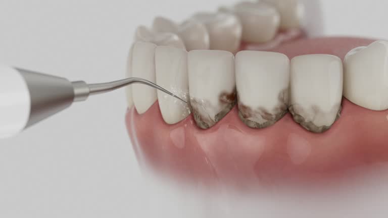 Trusted Teeth Cleaning And Checkup service in Tracy City, TN - Dentist Open Now